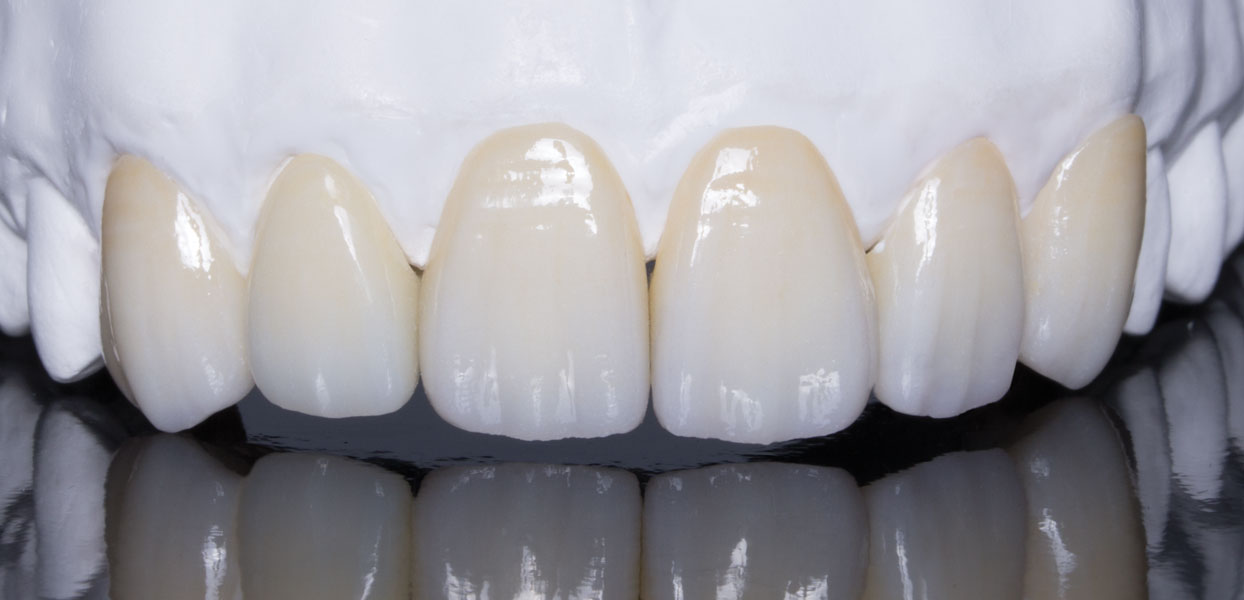Zirconia Dental Crown